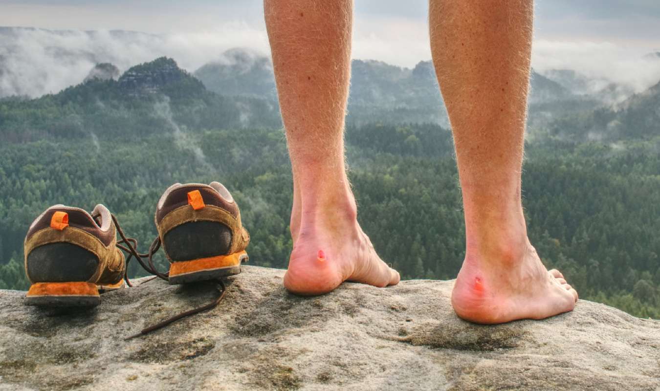 man with blisters on heels stands on rock
